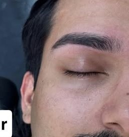 Eyebrow threading technique